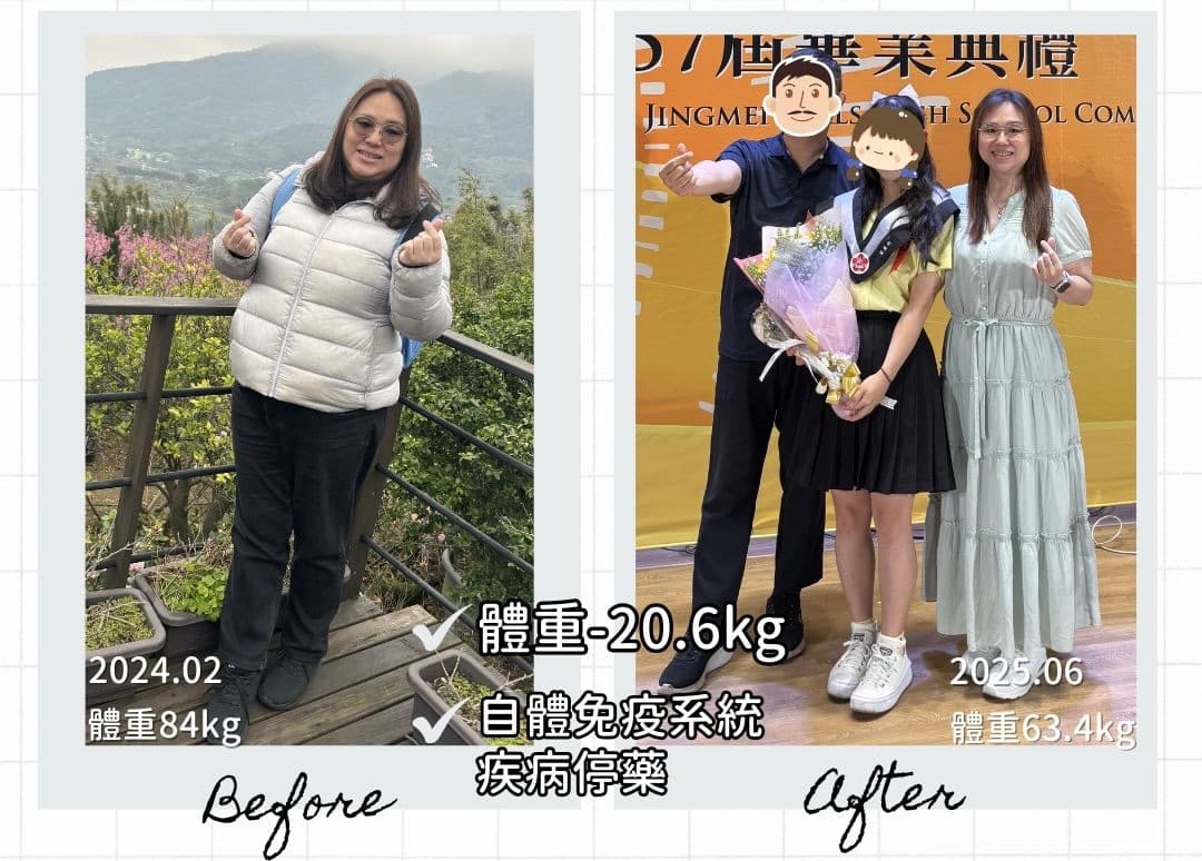 慧敏的瘦身前後對比:84kg到63.4kg,自體免疫疾病停藥